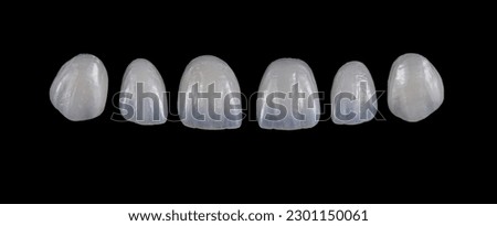 emax ceramic crowns and veneers Royalty-Free Stock Photo #2301150061