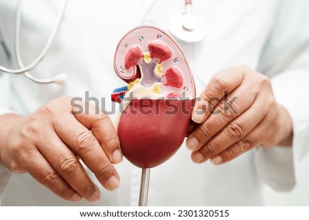 Chronic kidney disease, doctor holding model for treatment urinary system, urology, Estimated glomerular filtration rate eGFR. Royalty-Free Stock Photo #2301320515