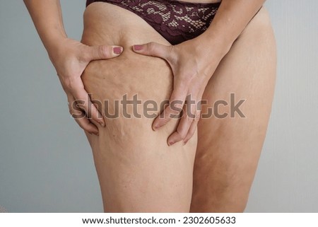White woman's legs with flab and cellulite, at home Royalty-Free Stock Photo #2302605633