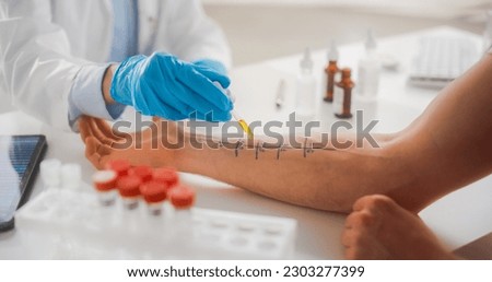 Close Up of a Patient Passing a Prick Scratch Allergy Test. Allergist Using Different Allergens on a Skin of a Young Man. Immunologist Diagnosing Allergy Triggers Royalty-Free Stock Photo #2303277399