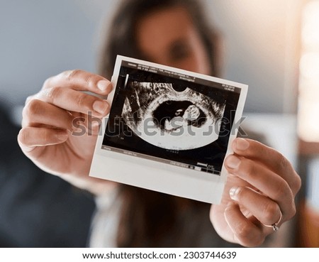 Hands, sonogram photo and closeup for woman, pregnancy and baby for health, wellness and growth. Ultrasound picture, fetus or infant development for healthcare, progress and monitor for unborn child