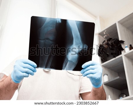 Doctor in the clinic, traumatologist analyzes a broken leg. X-ray of the knee. Ultrasound. Injury of the leg in the knee joint. Osteoporosis Royalty-Free Stock Photo #2303852667