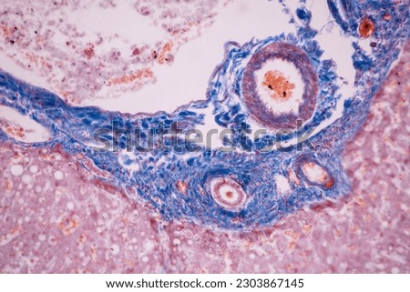 Histological Pancreas human, Liver human, Vermiform appendix human and Kidney Human under the microscope for education. Royalty-Free Stock Photo #2303867145