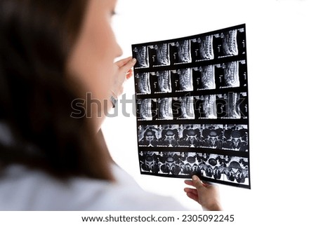 A woman doctor looks at an x-ray picture. Concept of hospital, doctor, neurologist, disease