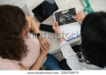 Top view doctor of ultrasound diagnostics, obstetrician gynecologist, holding ultrasound scan, explaining to pregnant woman the development of a child in the womb. Planned ultrasound in 2nd trimester. Royalty-Free Stock Photo #2305708979