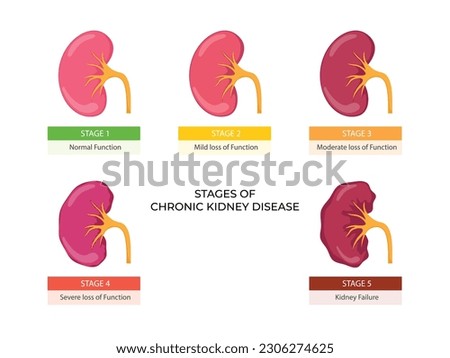Stages of chronic kidney disease. Problem in urinary system and normal kidney Royalty-Free Stock Photo #2306274625