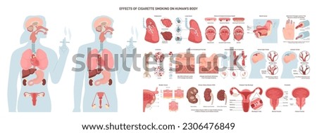 Effects of cigarette smoking on human body. Health issues and risks of smokers. Human internal organs diseases caused by nicotine. Flat vector illustration