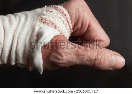 A close-up of a bandaged hand displaying remnants of a second-degree burn on the knuckle of the thumb and the aftermath of a burn injury on a black background. Proper care and treatment. Royalty-Free Stock Photo #2306505917