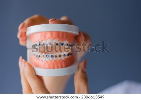 mock-up of a dental jaw with braces on a gray background, space for text Royalty-Free Stock Photo #2306613549