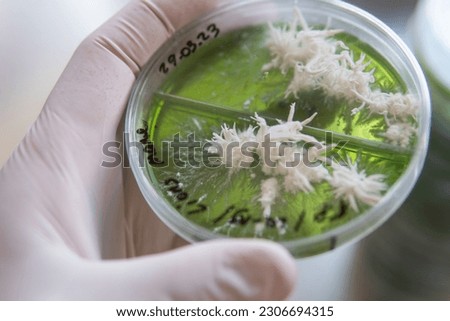 Popular medicinal mushrooms, the beneficial effects of the lions mane mushroom on humans. The future of mushrooms and their role in saving humanity. Petri dish with mycelium of mushroom culture