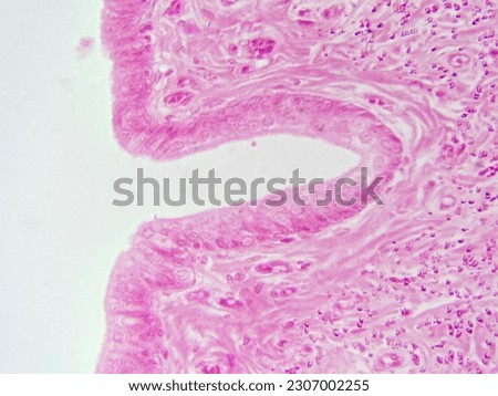 Zoomed In: Mammal Urethra Showing Transitional Epithelial Tissue at 400x Royalty-Free Stock Photo #2307002255