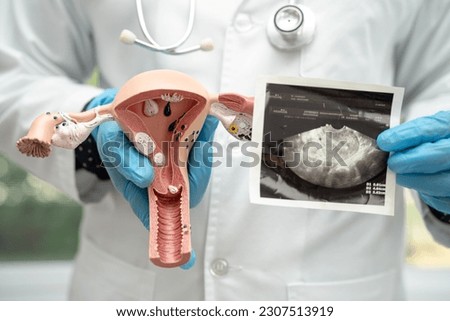 Uterus and ovary, doctor holding anatomy model and ultrasound picture for study diagnosis and treatment in hospital.