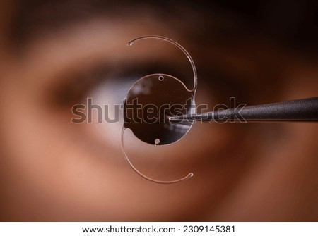 photo of intra ocular lens IOL for treating cataract infront of surgeon eye Royalty-Free Stock Photo #2309145381