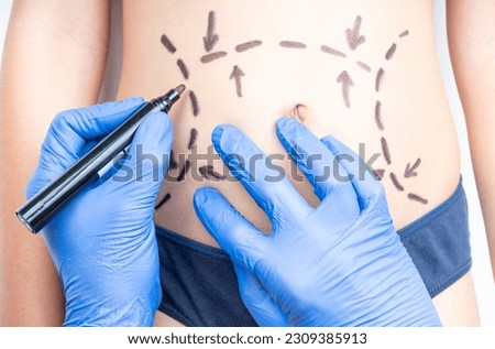 PLASTIC SURGEON'S HANDS DRAWING TUMMY TUCK OR ABDOMINOPLASTY SURGERY. ADOLESCENTS ADDICTION AND OBSESSION FOR BEAUTY PROCEDURES AND AESTHETIC OPERATIONS. BODY DYSMORPHIC DISORDERS. BDD. Royalty-Free Stock Photo #2309385913
