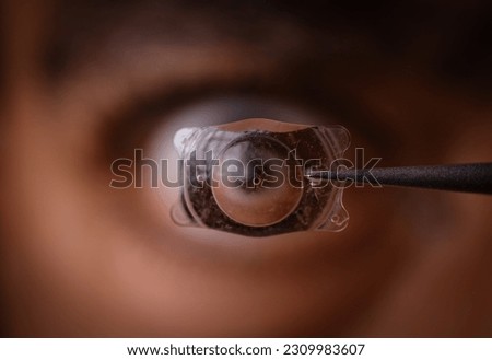 photo of Implantable Collamer Lens ICL for treating refractive errors, infront of a human eye Royalty-Free Stock Photo #2309983607