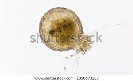 Testate amoeba genus Difflugia. Stacked photo Royalty-Free Stock Photo #2310693283