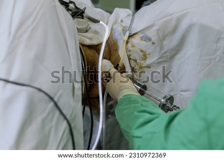 During TURP procedure resectoscope is introduced into urethra to remove excess prostate tissue and improve urinary flow. Royalty-Free Stock Photo #2310972369