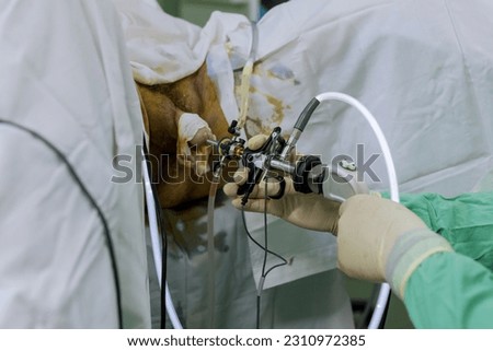 Transuretral resection of prostate is type endoscopic surgery in using special tool for resectoscope which is introduced along clearance of urethra Royalty-Free Stock Photo #2310972385