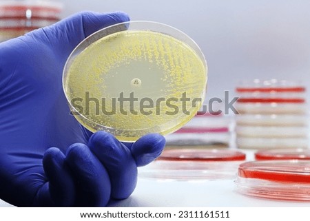 The rise of antibiotic-resistant bacterial infections. Superbugs. A microbiological culture Petri dish with bacteria where an antibiotic resistance test has been carried out Royalty-Free Stock Photo #2311161511