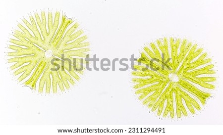 Beautiful phytoplankton, Micrasterias radiosa ssp. elegantior