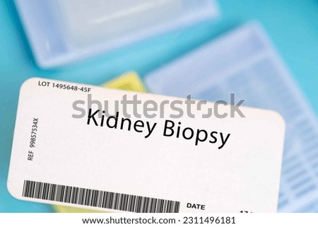 Kidney biopsy. A small piece of kidney tissue to evaluate for conditions such as kidney disease or kidney cancer. Royalty-Free Stock Photo #2311496181