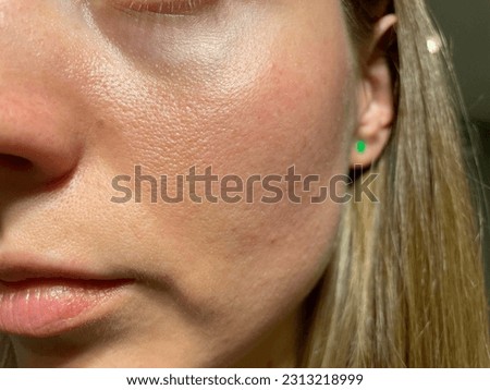 pores on the face. oily skin of the face Royalty-Free Stock Photo #2313218999