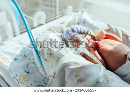 Child health, small newborn child lies in pressure chamber connected to an artificial respiration apparatus. Royalty-Free Stock Photo #2314056557