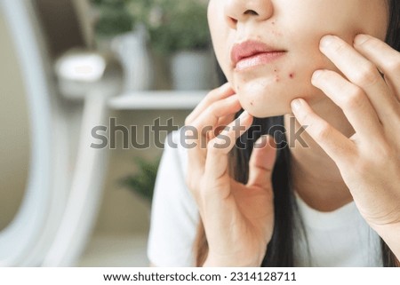 Expression worry asian young woman looking at mirror touching pustule around the chin and mouth, allergic when wear mask, spot scar from pimple on face. Beauty care, skin problem by acne treatment. Royalty-Free Stock Photo #2314128711
