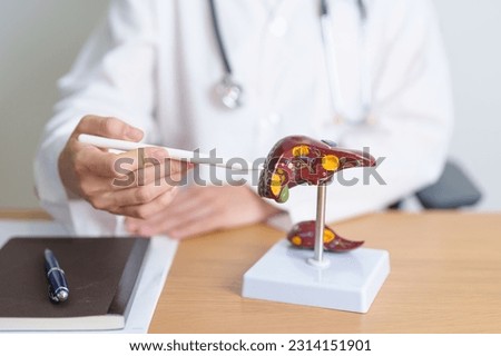 Doctor with human Liver anatomy model. Liver cancer and Tumor, Jaundice, Viral Hepatitis A, B, C, D, E, Cirrhosis, Failure, Enlarged, Hepatic Encephalopathy, Ascites Fluid in Belly and health concept Royalty-Free Stock Photo #2314151901