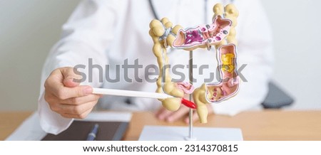 Doctor with human Colon anatomy model. Colonic disease, Large Intestine, Colorectal cancer, Ulcerative colitis, Diverticulitis, Irritable bowel syndrome, Digestive system and Health concept Royalty-Free Stock Photo #2314370815
