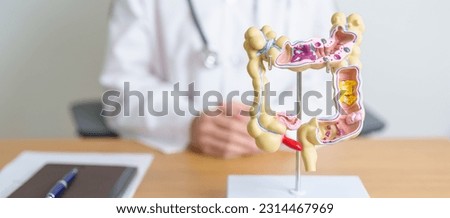 Doctor with human Colon anatomy model. Colonic disease, Large Intestine, Colorectal cancer, Ulcerative colitis, Diverticulitis, Irritable bowel syndrome, Digestive system and Health concept Royalty-Free Stock Photo #2314467969