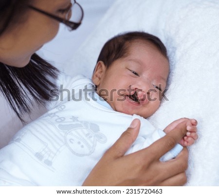 Newborn, cleft palate and parent care for a baby happy in a home bed with a smile in a bedroom or medical centre. Health, healthcare and young child or kid bonding with mother with love and comfort Royalty-Free Stock Photo #2315720463
