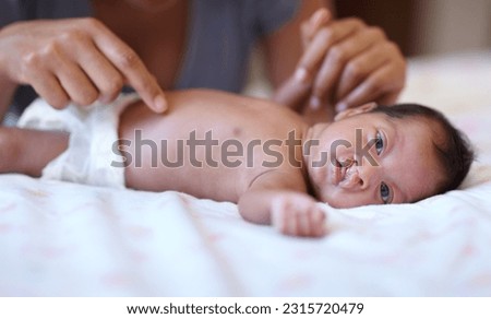 Care, portrait and a baby with a cleft palate being changed, playing and hands of a mother with love. Family, health and a newborn child with a disability and a mama or parent for childcare Royalty-Free Stock Photo #2315720479