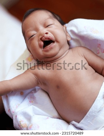 Cleft lip, baby and child birth with a portrait of a newborn crying in her crib at home. Childcare, young and infant girl kid with a medical condition laying on a blanket in her nursery in hospital Royalty-Free Stock Photo #2315720489