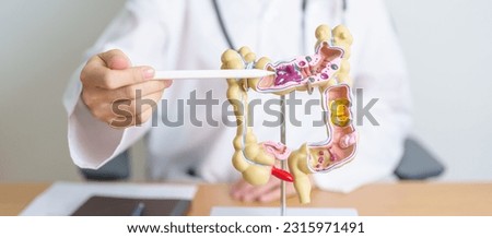 Doctor with human Colon anatomy model. Colonic disease, Large Intestine, Colorectal cancer, Ulcerative colitis, Diverticulitis, Irritable bowel syndrome, Digestive system and Health concept Royalty-Free Stock Photo #2315971491