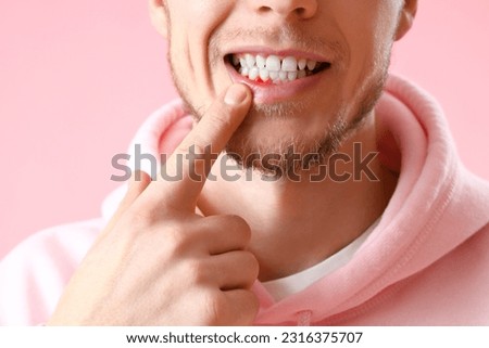 Man with gum inflammation on pink background, closeup Royalty-Free Stock Photo #2316375707