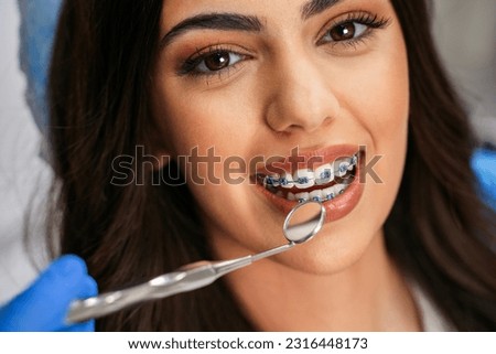 Closeup shot of charming young woman with dental braces having checkup , looking at camera, beautiful eye glow  Royalty-Free Stock Photo #2316448173