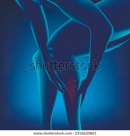 Human legs with varicose veins. Neon, glowing illustration. medical poster Royalty-Free Stock Photo #2316620861