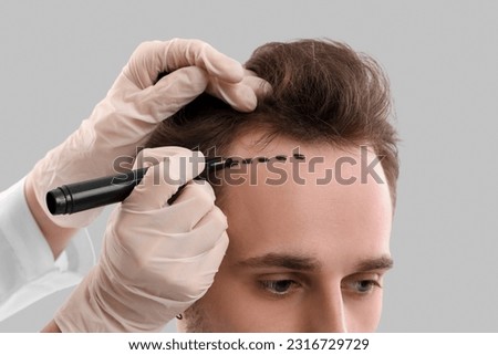 Doctor marking young man's forehead with hair loss problem on grey background, closeup Royalty-Free Stock Photo #2316729729