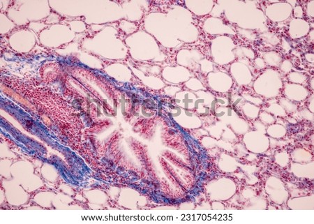 Human lung pathology under light microscope, The lungs is organs of the respiratory system in humans. Royalty-Free Stock Photo #2317054235
