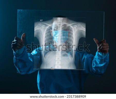 lung radiography concept. radiology doctor examining at chest x ray film of patient at hospital room. Royalty-Free Stock Photo #2317388909