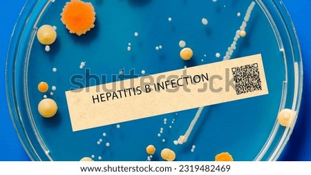 Hepatitis B - Viral infection that affects the liver and is transmitted through bodily fluids. Royalty-Free Stock Photo #2319482469