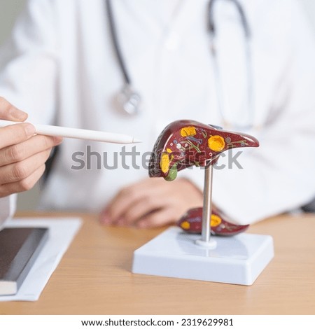 Doctor with human Liver anatomy model. Liver cancer and Tumor, Jaundice, Viral Hepatitis A, B, C, D, E, Cirrhosis, Failure, Enlarged, Hepatic Encephalopathy, Ascites Fluid in Belly and health concept Royalty-Free Stock Photo #2319629981