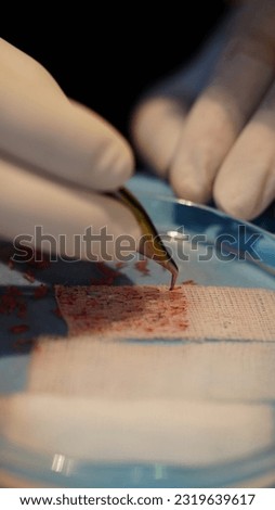 Hair transplant - grafts are held with a stapler. Dhi - Fue  Royalty-Free Stock Photo #2319639617