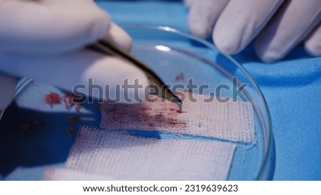 Hair transplant - grafts are held with a stapler. Dhi - Fue  Royalty-Free Stock Photo #2319639623