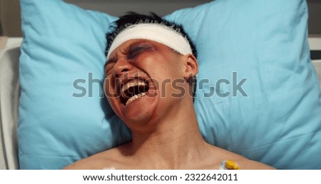 Injured young male patient with bruises on his face screaming in agony. Top view of wounded man lying on stretcher bed and crying in pain Royalty-Free Stock Photo #2322642011