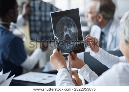 Hands of young assistant and female radiologist discussing scalp MRI scan of patient with traumatic brain injury against two male colleagues Royalty-Free Stock Photo #2322953895