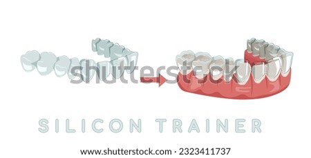 Orthodontic silicone trainer. Invisible braces aligner, retainer. Medical drawing in cartoon style. Outside view. Under jaw. Mandibula. Editable vector illustration isolated on a blue background. Royalty-Free Stock Photo #2323411737