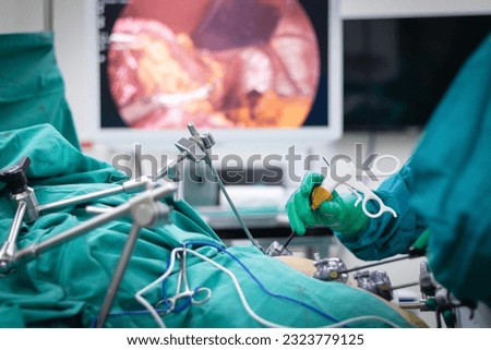 The surgeon's doing laparoscopic surgery in the operating room. Surgeons team hands during laparoscopic  sleeve gastrectomy. Tools for laparoscopic surgery Royalty-Free Stock Photo #2323779125