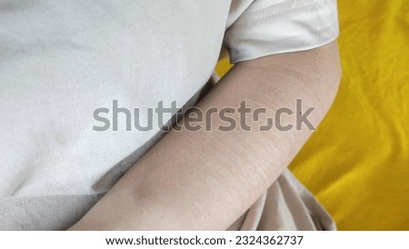 Woman's hand with cuts and scars from self-harm in despair, self-abuse, borderline personality disorder, self-mutilation	 Royalty-Free Stock Photo #2324362737